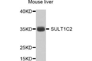 Western blot analysis of extract of various cells, using SULT1C2 antibody. (SULT1C2 antibody)