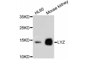 Western blot analysis of extracts of various cell lines, using LYZ antibody. (LYZ antibody)