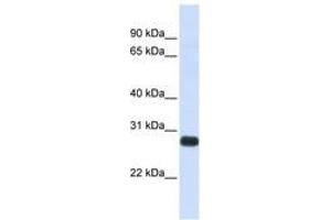 Image no. 1 for anti-serine Peptidase Inhibitor, Kunitz Type, 2 (SPINT2) (AA 180-229) antibody (ABIN6741061)