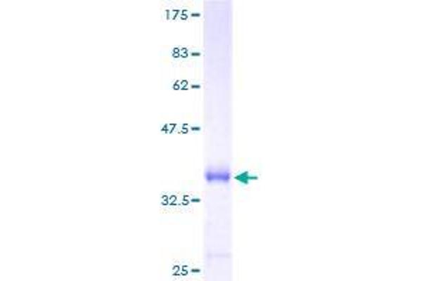 BRK1 Protein (AA 1-75) (GST tag)