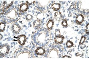 Human kidney (FOXF2 antibody  (N-Term))