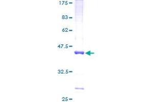 ETV3 Protein (AA 1-143) (GST tag)