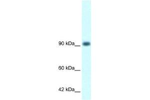 RBM10 antibody  (N-Term)