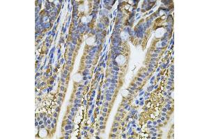 Immunohistochemistry of paraffin-embedded mouse intestine using NFU1 Antibody (ABIN5975479) at dilution of 1/100 (40x lens). (NFU1 antibody)