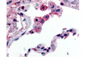 Anti-GPR43 antibody IHC of human lung, alveolar macrophages. (FFAR2 antibody  (C-Term))