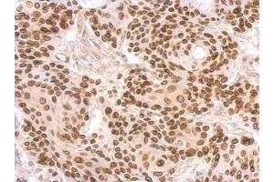 IHC-P Image Lamin B2 antibody [N3C2], Internal detects LMNB2 protein at on Cal27 xenograft by immunohistochemical analysis. (Lamin B2 antibody)