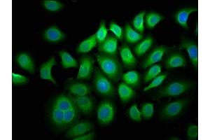 Immunofluorescence staining of A549 cells with ABIN7157997 at 1:33, counter-stained with DAPI. (LLGL1 antibody  (AA 953-1056))