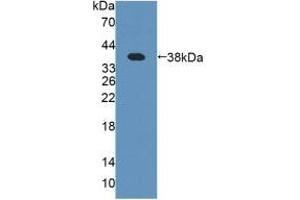 Detection of Recombinant PIIINP, Human using Polyclonal Antibody to Procollagen III N-Terminal Propeptide (PIIINP)