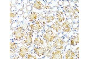 Immunohistochemistry of paraffin-embedded Mouse kidney using MAS1 Polyclonal Antibody at dilution of 1:100 (40x lens).