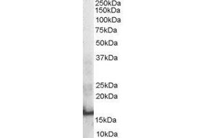 ABIN2559907 staining (0. (SH2D1A antibody  (Internal Region))