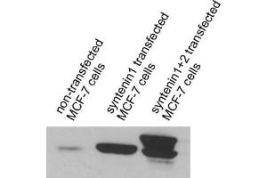 dilution: 1 : 100 (ECL detection), sample: cell lysates of MCF-7 cells (SDCBP antibody)