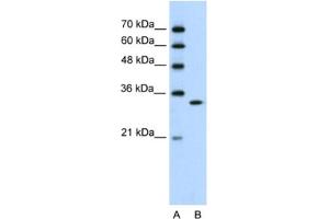 Western Blotting (WB) image for anti-Ribonuclease H2, Subunit A (RNASEH2A) antibody (ABIN2462212)
