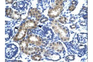 Image no. 1 for anti-SIX Homeobox 6 (SIX6) (AA 41-90) antibody (ABIN6735817) (SIX Homeobox 6 antibody  (AA 41-90))