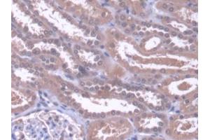 DAB staining on IHC-P; Samples: Human Kidney Tissue (ZNF10 antibody  (AA 1-244))