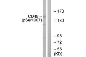 Western Blotting (WB) image for anti-Protein tyrosine Phosphatase, Receptor Type, C (PTPRC) (AA 981-1030), (pSer1007) antibody (ABIN1531546)