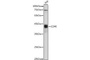 Western blot analysis of extracts of Raji cells, using CD40 antibody (ABIN3020703, ABIN3020704, ABIN3020705 and ABIN6213680) at 1:1000 dilution.