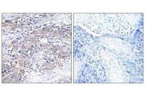 Immunohistochemistry analysis of paraffin-embedded human cervix tissue using CLN6 antibody. (CLN6 antibody)