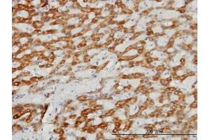 Image no. 1 for anti-Translocase of Inner Mitochondrial Membrane 8A (TIMM8A) (AA 9-98) antibody (ABIN598643) (TIMM8A/DDP antibody  (AA 9-98))