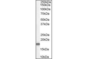 Image no. 1 for anti-Stathmin 1 (STMN1) (C-Term) antibody (ABIN374648) (Stathmin 1 antibody  (C-Term))