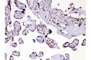 Immunohistochemistry (IHC) image for anti-Heterogeneous Nuclear Ribonucleoprotein A1 (HNRNPA1) (AA 8-42), (N-Term) antibody (ABIN4886621)