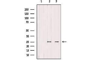 Western blot analysis of extracts from various samples, using ATP5F1 Antibody.