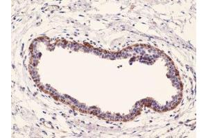 Immunohistochemistry (IHC) image for anti-Keratin 17 (KRT17) (C-Term) antibody (ABIN870563) (KRT17 antibody  (C-Term))