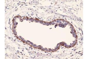 Immunohistochemistry (IHC) image for anti-Keratin 17 (KRT17) (C-Term) antibody (ABIN870564) (KRT17 antibody  (C-Term))