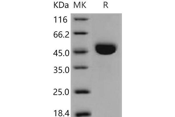 Cathepsin E Protein (CTSE) (AA 1-397) (His tag)