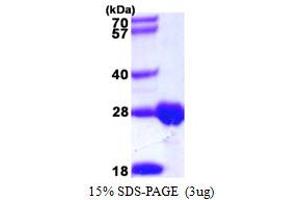 SDS-PAGE (SDS) image for Deoxythymidylate Kinase (Thymidylate Kinase) (DTYMK) (AA 1-212) protein (His tag) (ABIN667491) (DTYMK Protein (AA 1-212) (His tag))