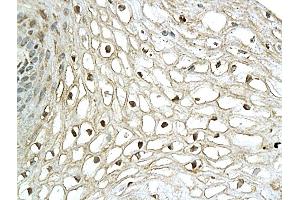 Formalin-fixed and paraffin embedded human cervical tissue labeled with Anti-XBP-1 Polyclonal Antibody, Unconjugated (ABIN732728) followed by conjugation to the secondary antibody and DAB staining (XBP1 antibody  (AA 51-150))