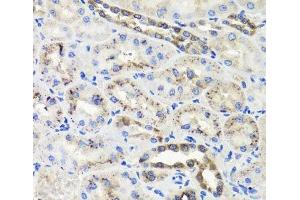 Immunohistochemistry of paraffin-embedded Rat kidney using HSD11B2 Polyclonal Antibody at dilution of 1:100 (40x lens). (HSD11B2 antibody)