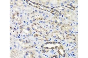 Immunohistochemistry of paraffin-embedded Rat kidney using HSD11B2 Polyclonal Antibody at dilution of 1:100 (40x lens).