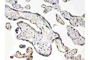 Immunohistochemistry (IHC) image for anti-High Mobility Group Box 1 (HMGB1) (AA 124-154), (C-Term) antibody (ABIN5518759)