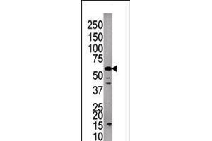 Western blot analysis of anti-PPP3CC Pab in A375cell line lysate. (PPP3CC antibody  (C-Term))