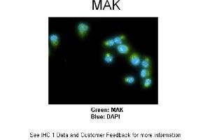 Sample Type :  Human lung adenocarcinoma cell line A549  Primary Antibody Dilution :  1:100  Secondary Antibody :  Goat anti-rabbit AlexaFluor 488  Secondary Antibody Dilution :  1:400  Color/Signal Descriptions :  MAK: Green DAPI:Blue  Gene Name :  MAK   Submitted by :  Dr.