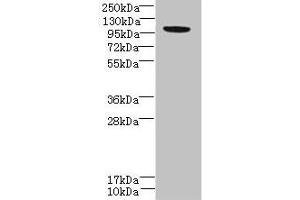 Western blot All lanes: PPFIBP2 antibody at 6 μg/mL + HepG2 whole cell lysate Secondary Goat polyclonal to rabbit at 1/10000 dilution Predicted band size: 99, 87, 84 kDa Observed band size: 99 kDa (PPFIBP2 antibody  (AA 101-400))