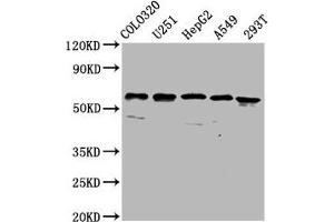 Western Blot Positive WB detected in: Colo320 whole cell lysate, U251 whole cell lysate, HepG2 whole cell lysate, A549 whole cell lysate, 293T whole cell lysate All lanes: CLCC1 antibody at 3.