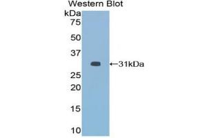 Detection of Recombinant HDAC6, Mouse using Polyclonal Antibody to Histone Deacetylase 6 (HDAC6) (HDAC6 antibody  (AA 560-811))