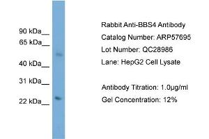 WB Suggested Anti-BBS4  Antibody Titration: 0. (BBS4 antibody  (N-Term))