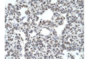 TMPRSS11D antibody was used for immunohistochemistry at a concentration of 4-8 ug/ml. (TMPRSS11D antibody  (N-Term))