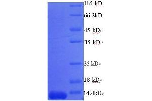 SDS-PAGE (SDS) image for Metallo-beta-Lactamase (NDM-1) (AA 88-146), (partial) protein (His tag) (ABIN5712540) (NDM-1 Protein (AA 88-146, partial) (His tag))