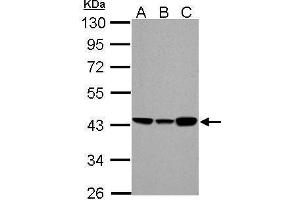 WB Image ACADM antibody detects ACADM protein by Western blot analysis. (Medium-Chain Specific Acyl-CoA Dehydrogenase, Mitochondrial (Center) antibody)