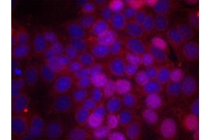 Immunofluorescence staining of methanol-fixed MCF-7 cells using Phospho-ESR1-S106 antibody (ABIN2988004). (Estrogen Receptor alpha antibody  (pSer106))