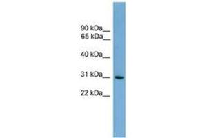 Image no. 1 for anti-Major Histocompatibility Complex, Class II, DQ alpha 2 (HLA-DQA2) (AA 35-84) antibody (ABIN6744866)