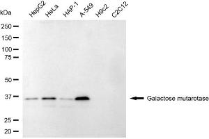 anti-Galactose Mutarotase (Aldose 1-Epimerase) (GALM) antibody