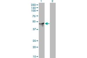 Western Blotting (WB) image for anti-Cytohesin 2 (CYTH2) (AA 314-399) antibody (ABIN466143) (Cytohesin 2 antibody  (AA 314-399))