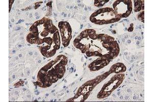 Immunohistochemical staining of paraffin-embedded Human Kidney tissue using anti-ATP6V1B1 mouse monoclonal antibody. (ATP6V1B1 antibody)