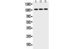 Western blot analysis of AP2B1 expression in rat testis extract ( Lane 1), mouse brain extract ( Lane 2) and MCF-7 whole cell lysates ( Lane 3). (AP2B1 antibody  (AA 311-522))