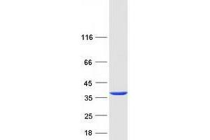 Validation with Western Blot (Tropomyosin 4 Protein (TPM4) (Transcript Variant 2) (Myc-DYKDDDDK Tag))