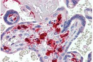 Human Placenta (formalin-fixed, paraffin-embedded) stained with F13A1 antibody ABIN462397 followed by biotinylated secondary antibody, alkaline phosphatase-streptavidin and chromogen. (F13A1 antibody)